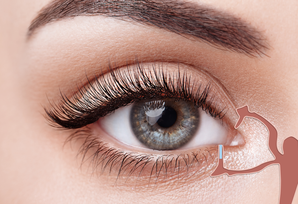 Dry Eye Syndrome in Las Vegas Henderson Centennial NV