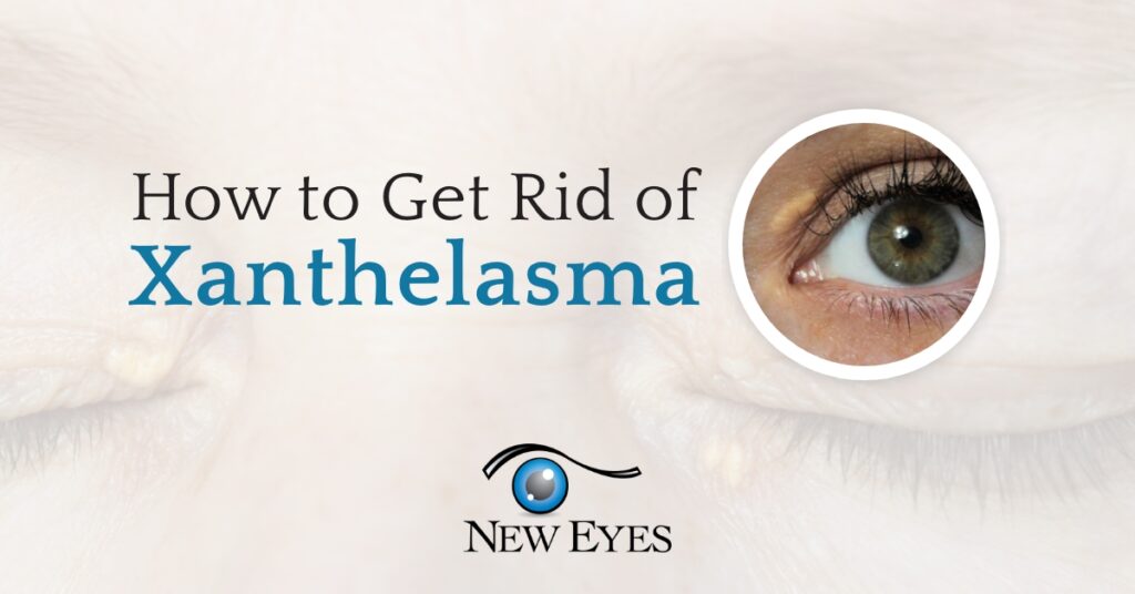 How to Get Rid of Xanthelasma
